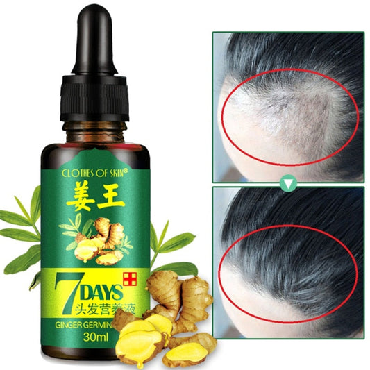 7 Days Ginger Essence Hairdressing Hairs Mask Hair Essential Oil Hair Care Oil Essential Oil Dry and Damaged Hairs Nutrition