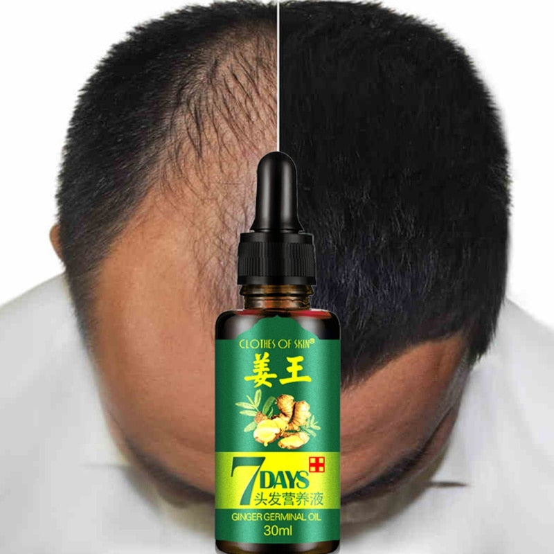 7 Days Ginger Essence Hairdressing Hairs Mask Hair Essential Oil Hair Care Oil Essential Oil Dry and Damaged Hairs Nutrition